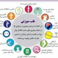 اموزش طب سوزنی