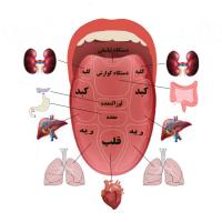 تشخیص بیماری از زبان افلاین